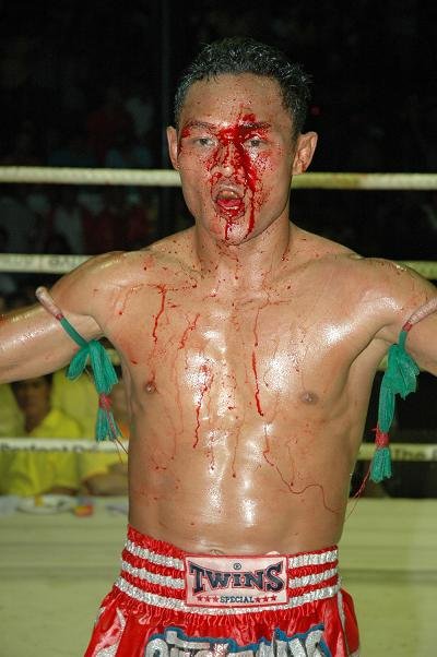 A-SAENCHAI-MUAY-THAI-FIGHT-CUTS1