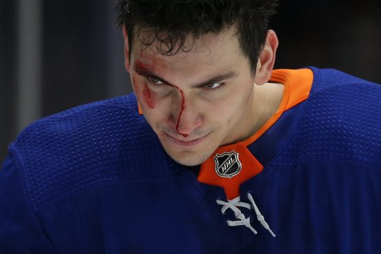 Feb 25, 2020; Uniondale, New York, USA; New York Islanders left wing Michael Dal Colle (28) leaves the ice with a bloody face after being checked by New York Rangers defenseman Jacob Trouba (not pictured) during the third period at Nassau Veterans Memorial Coliseum. Mandatory Credit: Brad Penner-USA TODAY Sports
