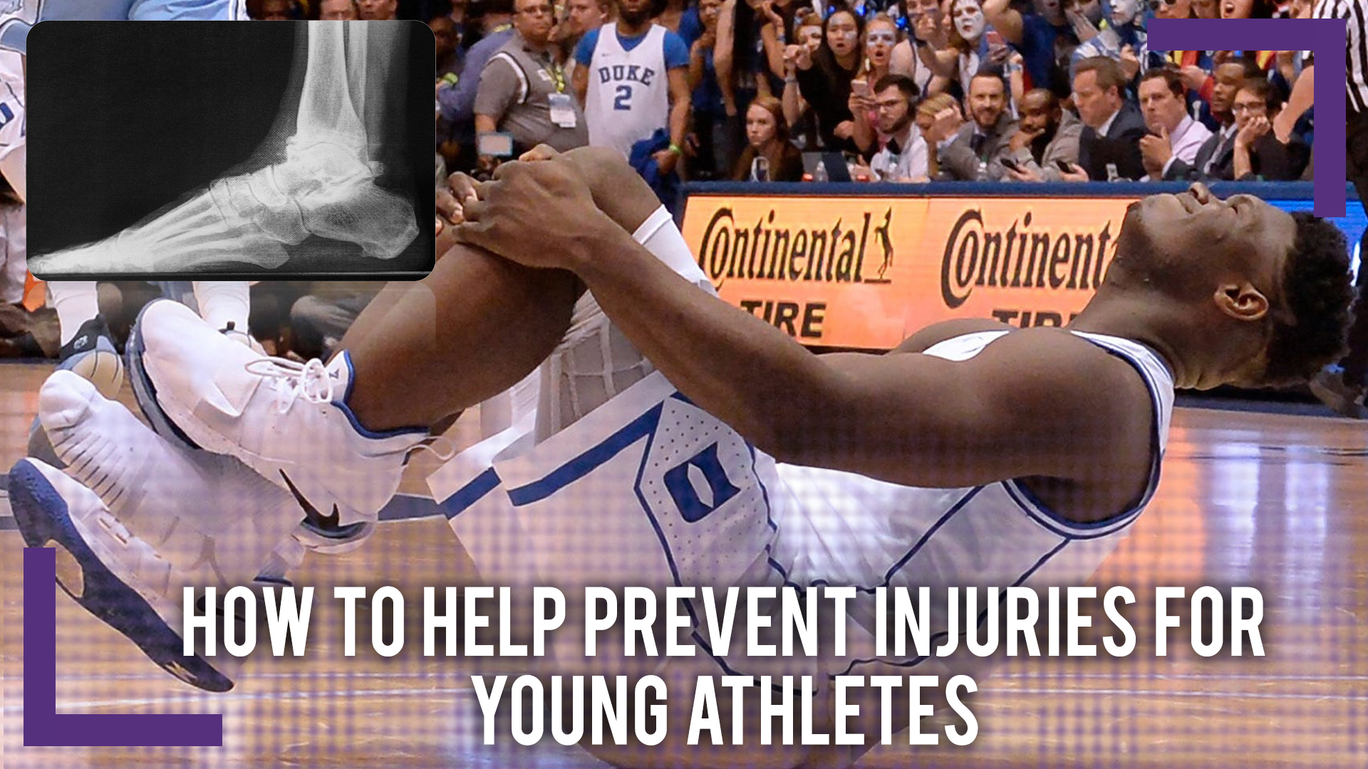 The TRUTH Behind Basketball Injuries & How To Help Prevent Them